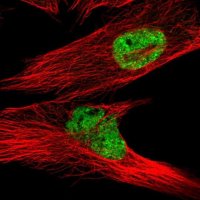 Anti-PLPPR2 antibody produced in rabbit 