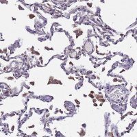 Anti-PLXDC2 antibody produced in rabbit 