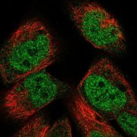 Anti-PM20D2 antibody produced in rabbit HPA030326-100UL