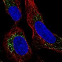 Anti-PMEPA1 antibody produced in rabbit