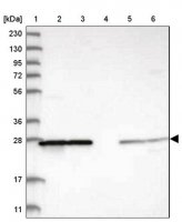 Anti-PMM1 antibody produced in rabbit HPA030712-100UL
