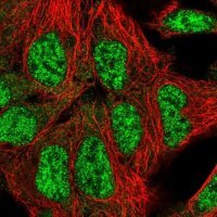 Anti-PNISR antibody produced in rabbit 