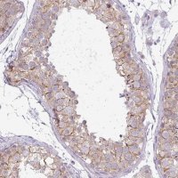 Anti-PNLDC1 antibody produced in rabbit