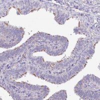 Anti-PNLDC1 antibody produced in rabbit