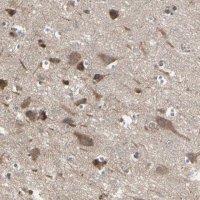 Anti-PNPLA7 antibody produced in rabbit 