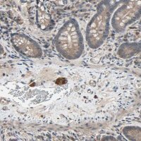 Anti-PNPLA7 antibody produced in rabbit 