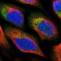 Anti-PNPLA8 antibody produced in rabbit