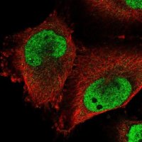 Anti-POC5 antibody produced in rabbit 