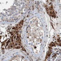 Anti-POLG2 antibody produced in rabbit