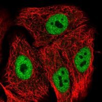 Anti-POLR2M antibody produced in rabbit 