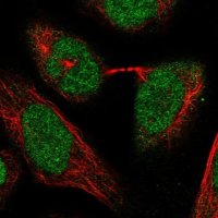 Anti-POLR3C antibody produced in rabbit