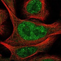 Anti-POLR3D antibody produced in rabbit 