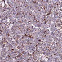 Anti-POTEE antibody produced in rabbit 