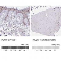 Anti-POU2F3 antibody produced in rabbit 