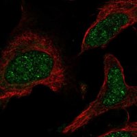 Anti-PPARA antibody produced in rabbit 