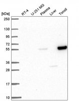 Anti-PPARA antibody produced in rabbit 