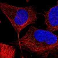 Anti-PPAT antibody produced in rabbit