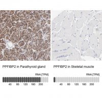 Anti-PPFIBP2 antibody produced in rabbit 