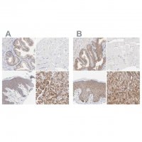 Anti-PPFIBP2 antibody produced in rabbit 