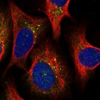 Anti-PPIP5K2 antibody produced in rabbit