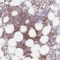 Anti-PPM1A antibody produced in rabbit 