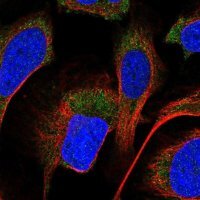 Anti-PPM1A antibody produced in rabbit 