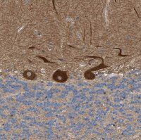 Anti-PPM1B antibody produced in rabbit HPA016745-100UL
