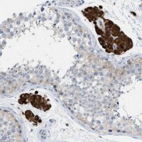 Anti-PPM1D antibody produced in rabbit 