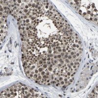 Anti-PPM1E antibody produced in rabbit 