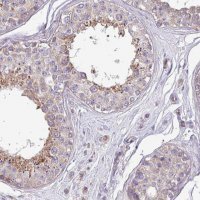 Anti-PPM1J antibody produced in rabbit 