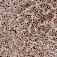 Anti-PPOX antibody produced in rabbit 
