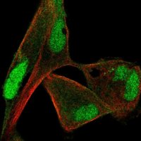 Anti-PPP1CB antibody produced in rabbit 