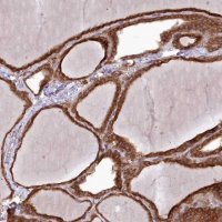 Anti-PPP1R21 antibody produced in rabbit 