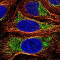 Anti-PPP1R3E antibody produced in rabbit 