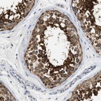 Anti-PPP2R1B antibody produced in rabbit 