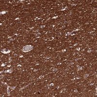 Anti-PPP2R2B antibody produced in rabbit 