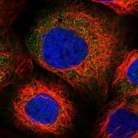 Anti-PPP2R2B antibody produced in rabbit 