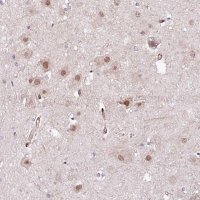 Anti-PPP2R5B antibody produced in rabbit 