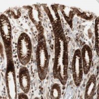 Anti-PPP2R5E antibody produced in rabbit 