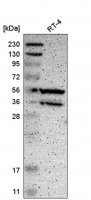 Anti-PPP3CB antibody produced in rabbit HPA008823-100UL