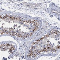 Anti-PPP3CC antibody produced in rabbit