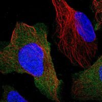 Anti-PPP3R1 antibody produced in rabbit 