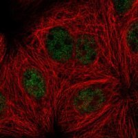 Anti-PPP4R3A antibody produced in rabbit 