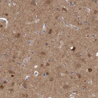 Anti-PPP5C antibody produced in rabbit HPA029065-100UL