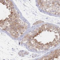 Anti-PPP6C antibody produced in rabbit 