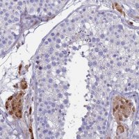 Anti-PPP6R1 antibody produced in rabbit HPA043989-100UL