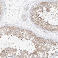 Anti-PPP6R2 antibody produced in rabbit 