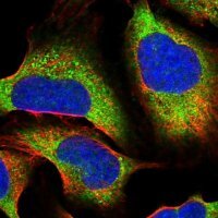 Anti-PPP6R2 antibody produced in rabbit 