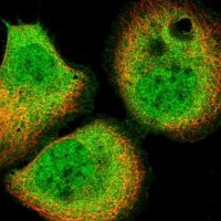 Anti-PPP6R3 antibody produced in rabbit 