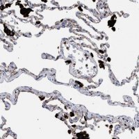 Anti-PPT1 antibody produced in rabbit 